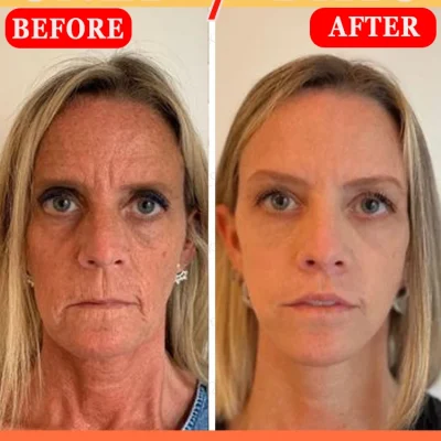 Retinol Facial Essence Moisturizing Firming, Rejuvenating Anti-aging Makeup Skin Care Products