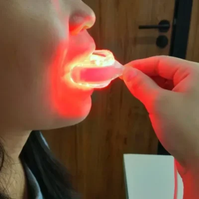 Starlite Smile Gum Disease Treatment, Periodontal Treatment Oral Care Red Light Therapy Promotes Healing and Pain Relief